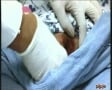 BALLS INJURY 2