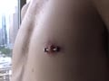 touched foreskin