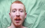 Gingers