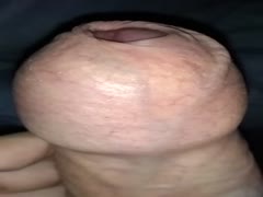 Foreskin