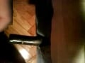 foreskin
