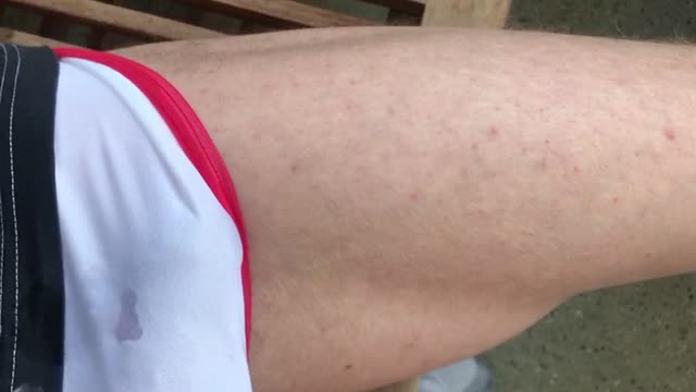 wet shorts on balcony 