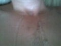 me vid 2