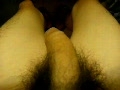 My erection 3